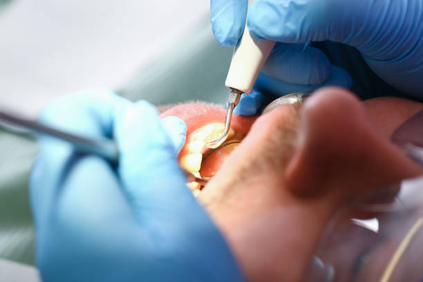 Best After-Hours Emergency Dentist in Eastwood, MI