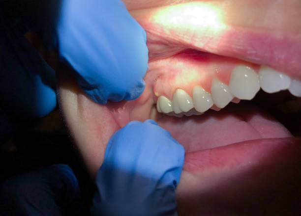 Best Walk-In Emergency Dentist in Eastwood, MI